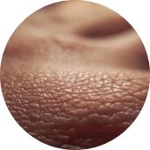 TYPE I COLLAGEN